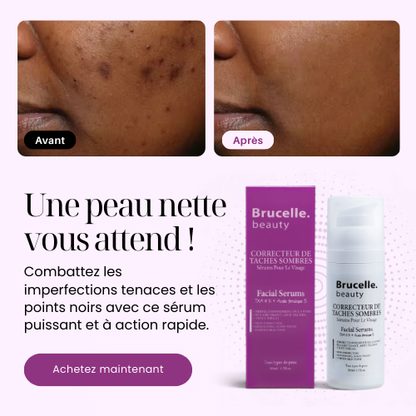 SÉRUM ANTI-TACHES ULTRA ÉCLAIRCISSANT